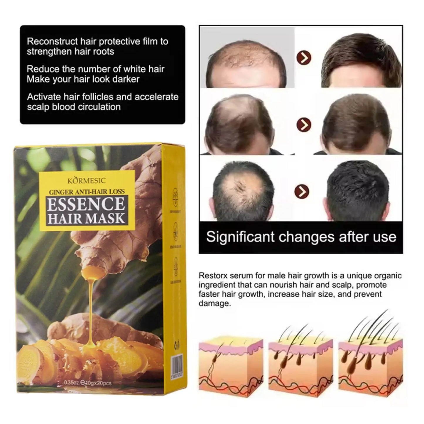 Fast Ginger Hair Growth Cream – Anti Hair Loss, Root Strengthening & Scalp Repair Serum