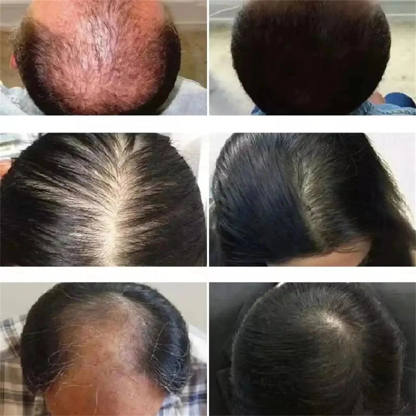 Fast Ginger Hair Growth Cream – Anti Hair Loss, Root Strengthening & Scalp Repair Serum