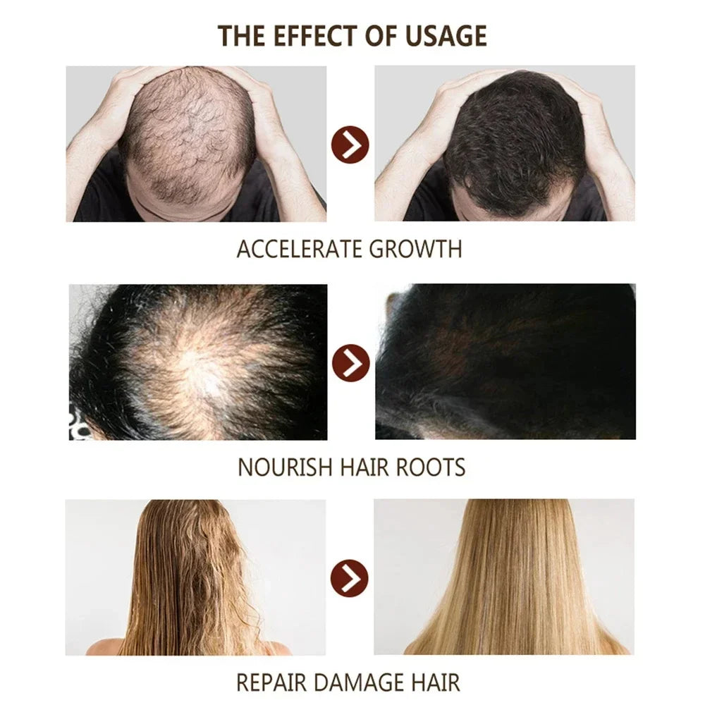 Fast Ginger Hair Growth Cream – Anti Hair Loss, Root Strengthening & Scalp Repair Serum