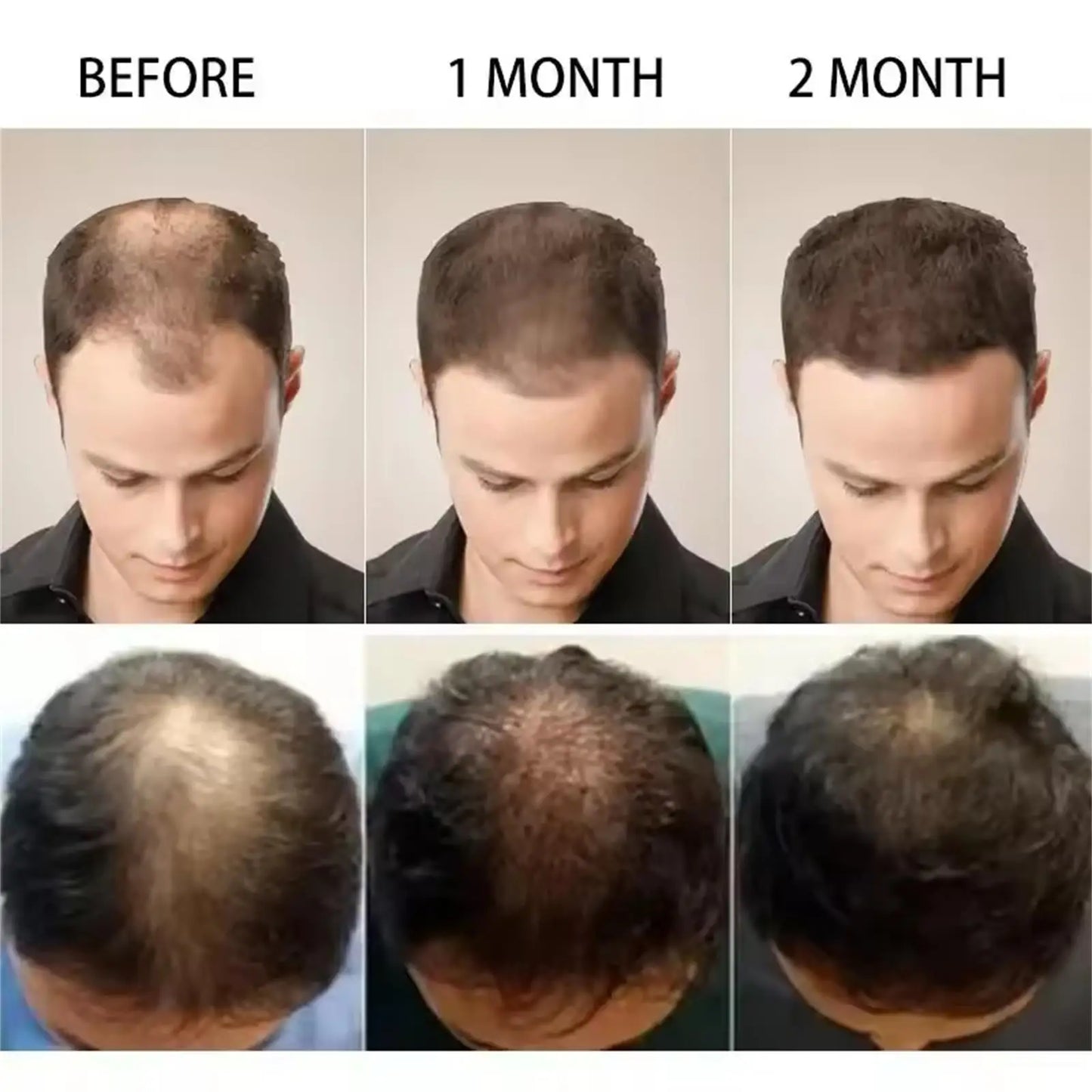 Fast Ginger Hair Growth Cream – Anti Hair Loss, Root Strengthening & Scalp Repair Serum