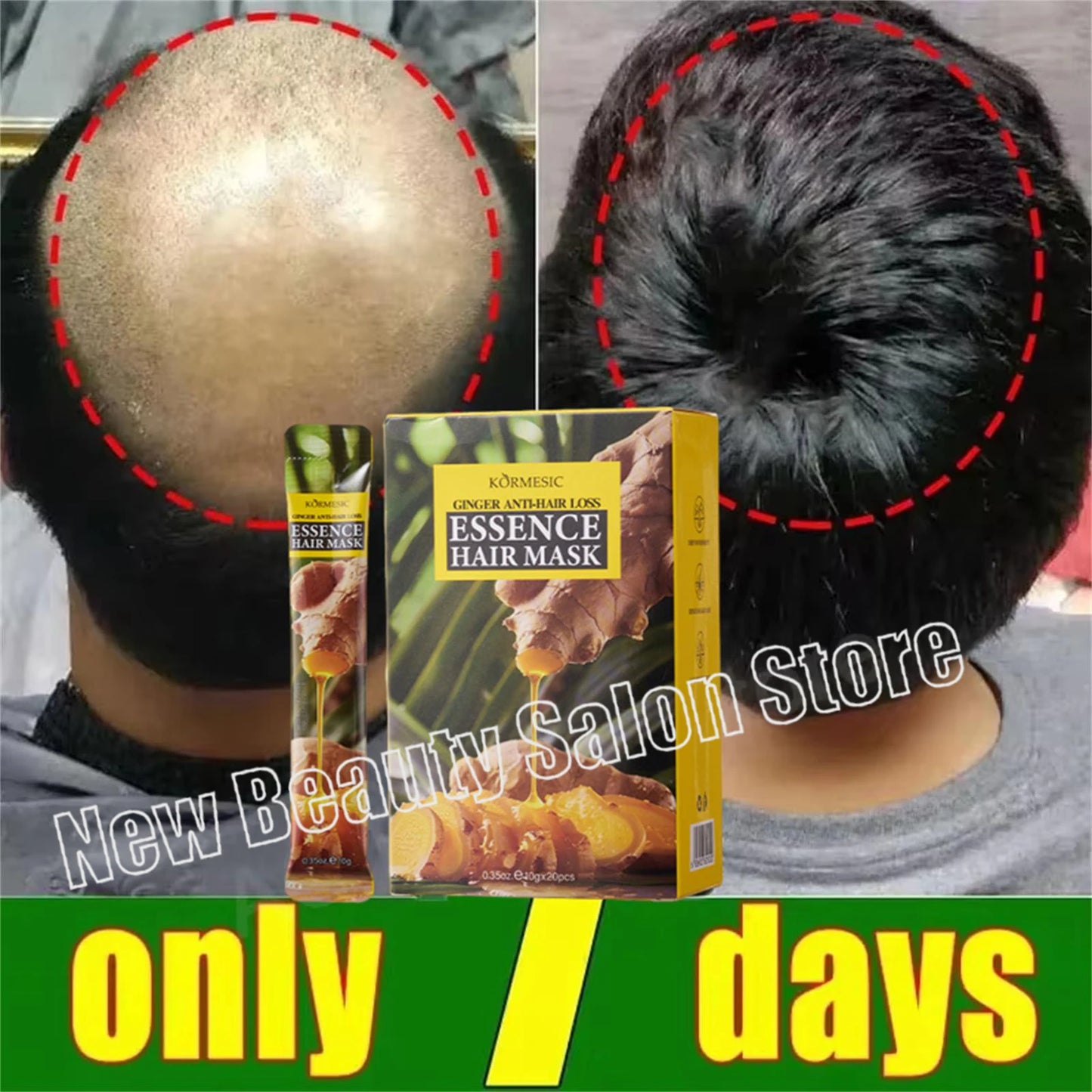 Fast Ginger Hair Growth Cream – Anti Hair Loss, Root Strengthening & Scalp Repair Serum